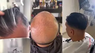 Greffe synth&eacute;tique vs Compl&eacute;mentCapillaire 🔥