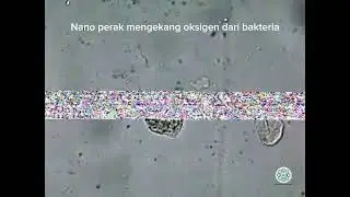 Bakteria di dalam larutan nano perak.