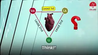 ECG Basics: Which Electrode is Positive in Lead I? (Einthoven&rsquo;s Triangle) | NNL ONE