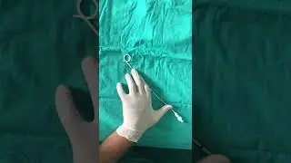 Pigtail Cope Loop Catheter Demonstration-1