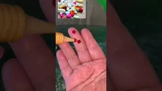 acupressure points for reduce side effects of antibiotics naturally ( part 1) #nepali #shortsvideo