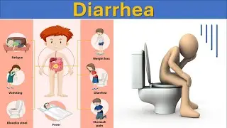 Diarrhea: Causes, Symptoms, and Treatments | Digestive Health