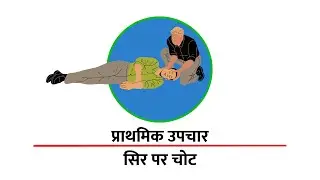 First Aid For Head Injury (Hindi) | सिर पर चोट में प्राथमिक उपचार