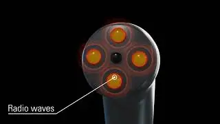 Z Shape - Vacuum-Assisted Radiofrequency for Aesthetics