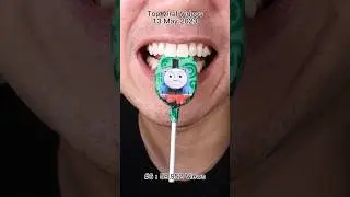 ASMR | Thomas Train Chocolate Lollipop #doctortristanpeh #asmr #lollipop