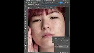 Remove Acne Super Fast With Photoshop AI