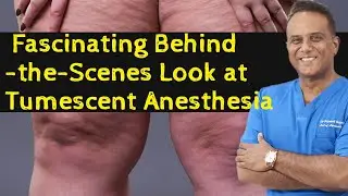 Tumescent Anaesthesia  and How it works?  EPISODE 1