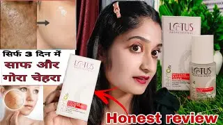 Lotus Phytorx Whitening & Brightening Face Serum Honest Review | Indigenous beauty #lotus  #serum