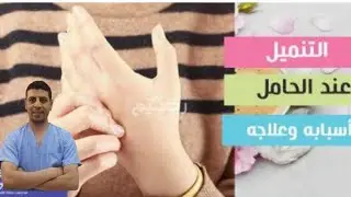 تنميل اليدين| تنميل اليدين أثناء النوم للحامل|أسباب متلازمة النفق الرسغي|دكتور احمد حسن جمعه