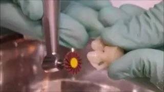 Spiral Polishers for Lithium Di-Silicate