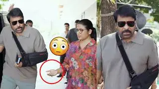 Chiranjeevi After Accident Visuals | Megastar Injured In Vishwambhara Sets
