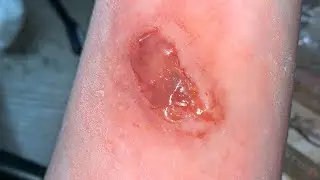 How to use 3rd degree silicone modelling compound