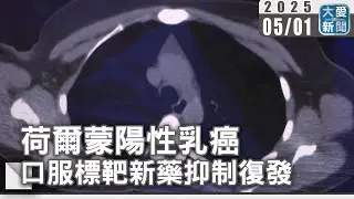 荷爾蒙陽性乳癌 口服標靶新藥抑制復發｜大愛新聞 @DaaiWorldNews