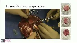 State of the Union in Appendiceal Cancer