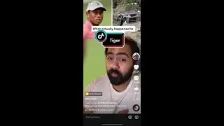 Doctor reacts to Tiger Woods injury #shorts