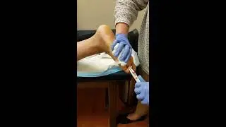 Pins out of toes....just in time for summer!!
