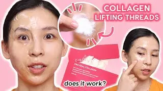 Trying Collagen Lifting Threads - Does it work? | TINA TRIES IT