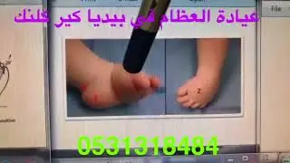 القدم الحنفاء