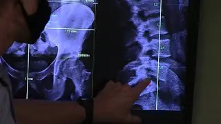 Ricardo reports neck pain, dizziness, tremendous pain gone after Gonstead Chiropractic San Diego