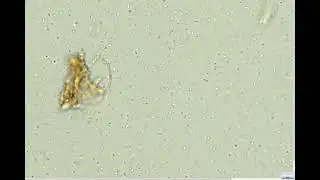 Microscopic Journey thru EM1 Bokashi