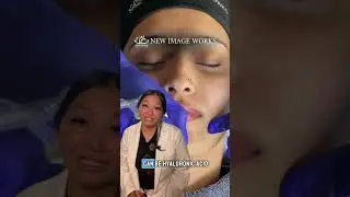 DiamondGlow Facial: The Secret to Clear, Glowing Skin (Beyond At-Home Skincare)