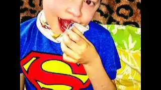 Atr-x   Syndrome.My Boys .Dominik and Alexander.both  diagnosed 2014.