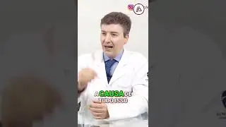 A import&acirc;ncia do tratamento adequado para varizes: Saiba a causa por tr&aacute;s!