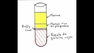 ¿Cómo ENGAÑAN con el Plasma rico en Plaquetas?
