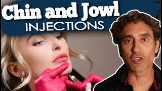 RESTYLANE DEFYNE CHIN and JOWLS INJECTIONS // Tighten and Contour Your Chin