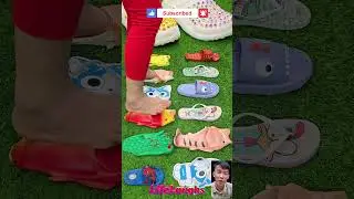 Trendy Giant Eye Slippers 🦶👀 & Fish Slippers 🐬: Must-Have Styles!
