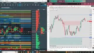 TOOS: Forex Somali Trading LONDON Session | 11th, Nov, 2025| With #Hagarlaawe
