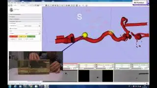 Guiding neurovascular catheter using electromagnetic tracking system