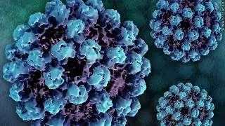 Covering Your Health: Norovirus Outbreak in Acadiana