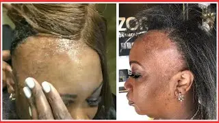 PLEASE STOP DOING THIS LADIES - THE TRUTH ABOUT WIG GLUE