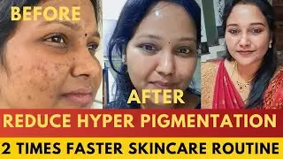 தமிழில் - 🔥🔥🔥Reduce 2 times faster skincare routine for pigmentation #skincareroutine #pigmentation