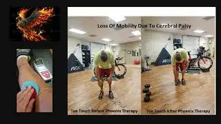 Neurotherapy with the Phoenix Waveform - Unlock your true potential!
