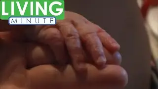 Is Hand Foot and Mouth Disease Contagious to Adults? | Living Minute