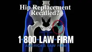 1-800-LAW-FIRM - Hip Replacement Recall (2013)