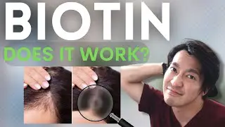 BIOTIN for HAIR LOSS - The TRUTH from a DERMATOLOGIST