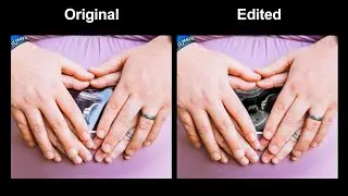 Fix Light Glare on Sonogram Photo