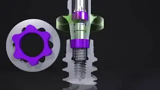 Straumann&reg; BLX TorcFit - Tactile Feedback
