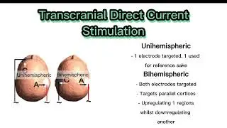 tDCS as a treatment for Schizophrenia Symptoms