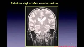 Artefatti in RM