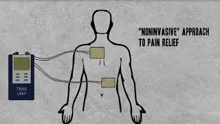 TENS Unit Transcutaneous Electrical Nerve Stimulation Pain Relief Electrode DynaMD Medical Supply