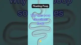 Why does poop sometimes float?