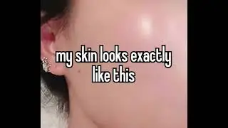 clear skin subliminal *use everynight*