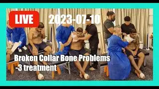 Broken Collar Bone Problems  -3 treatment -5