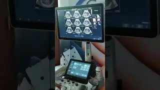 Un paso a paso con el HS40v1 04 de Samsung. 4