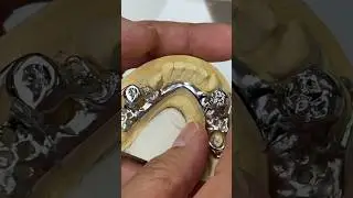 Metal Partial Framework #lsk121shorts #teeth #dental