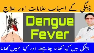 Dengue fever symptoms diagnosis treatment | 5 Foods to Eat in Dengue | Dengue Bukhar mai Kya Khaen